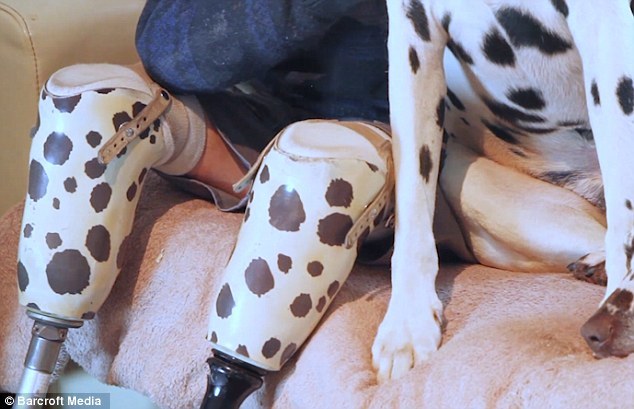 A pöttyös műlábat sokan megdicsérik az utcán