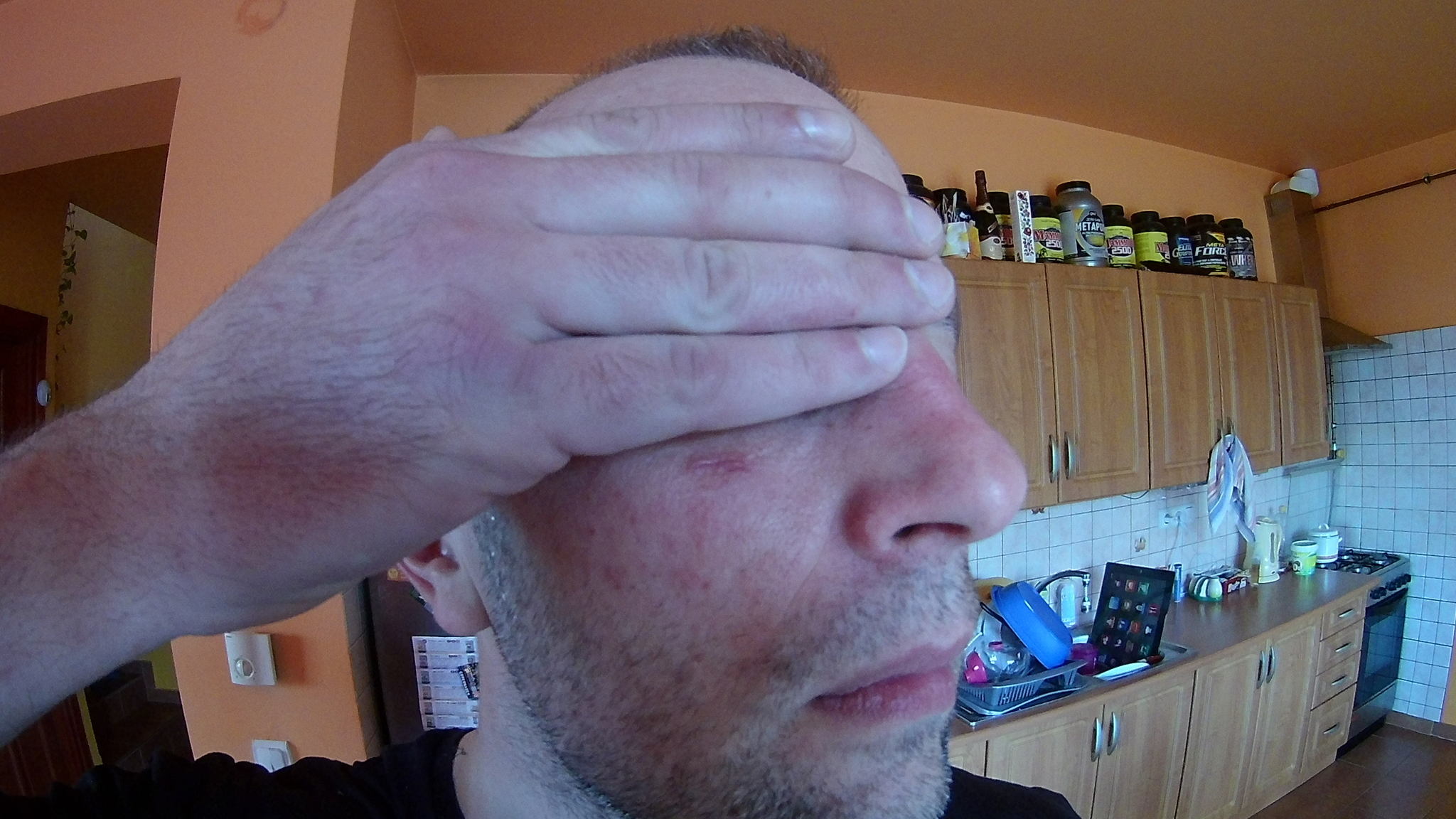 A gazdinak szerencséje volt. 3 cm és a szemét éri a neveletlen kölyökkutya harapása.