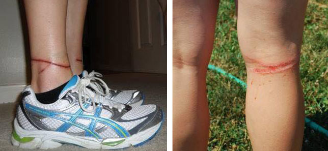 A flexi póráz a gazdiban és a járókelőkben is kárt tehet, ha nem figyelünk oda